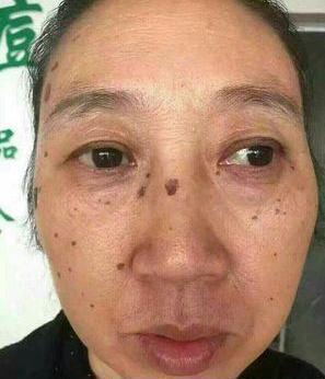 去老年斑的簡(jiǎn)單方法，重拾肌膚光彩的秘訣，去老年斑秘籍，重拾肌膚光彩的簡(jiǎn)易方法
