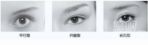 平扇與開扇雙眼皮，哪種更適合你？哪個更好看？，雙眼皮手術(shù)，平扇與開扇風格的選擇與美觀度探討