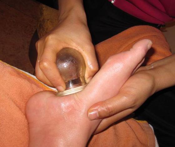 拔火罐對腎虛有好處嗎？深度解析傳統(tǒng)療法與現(xiàn)代健康理念，拔火罐對腎虛的益處解析，傳統(tǒng)療法與現(xiàn)代健康理念融合探索