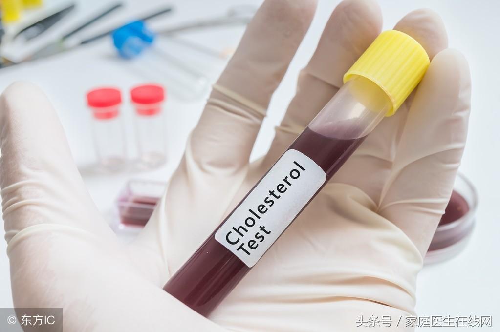 糖尿病的成因，深度解析其背后的原因，深度解析糖尿病成因，揭示背后原因真相