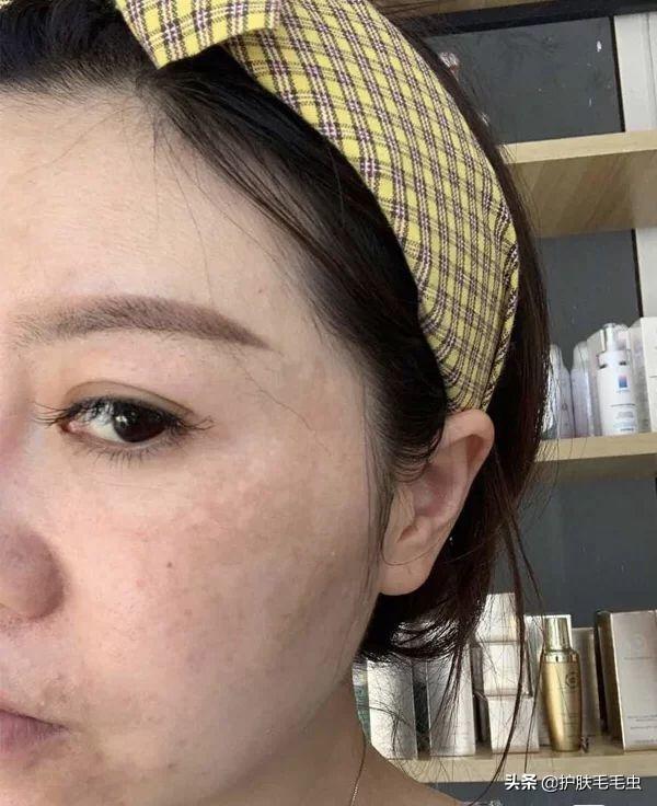 怎樣有效的淡化黃褐斑——全方位美白祛斑攻略，全方位美白祛斑攻略，如何有效淡化黃褐斑