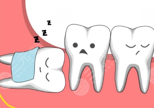 拔智齒后恢復(fù)正常的天數(shù)，全面解析與照顧指南，拔智齒后恢復(fù)全攻略，照顧指南與恢復(fù)天數(shù)詳解