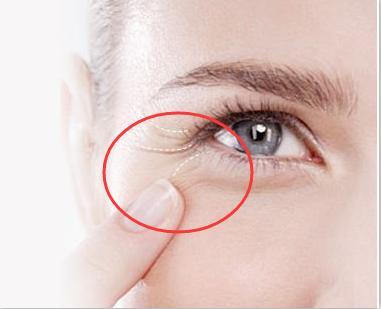 如何去除魚(yú)尾紋，最佳方法與實(shí)用建議，去除魚(yú)尾紋，最佳方法與實(shí)用建議攻略